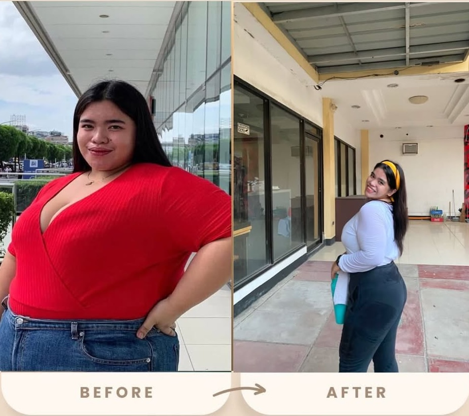 Before and After Weight Loss Transformation at Weight and Body Solutions Tampa Bay