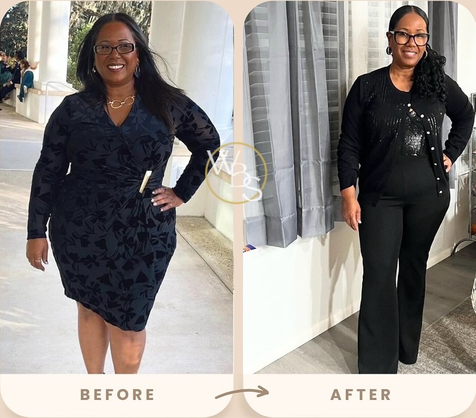 Before and After Weight Loss Transformation at Weight and Body Solutions Tampa Bay