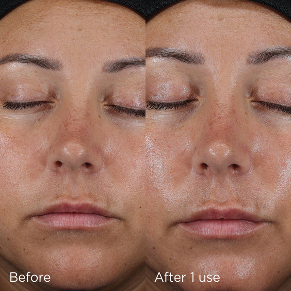 DAILY PREVENTION™ ultra defense moisturizer SPF 50