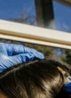 plasma-injections-for-hair-loss-featured