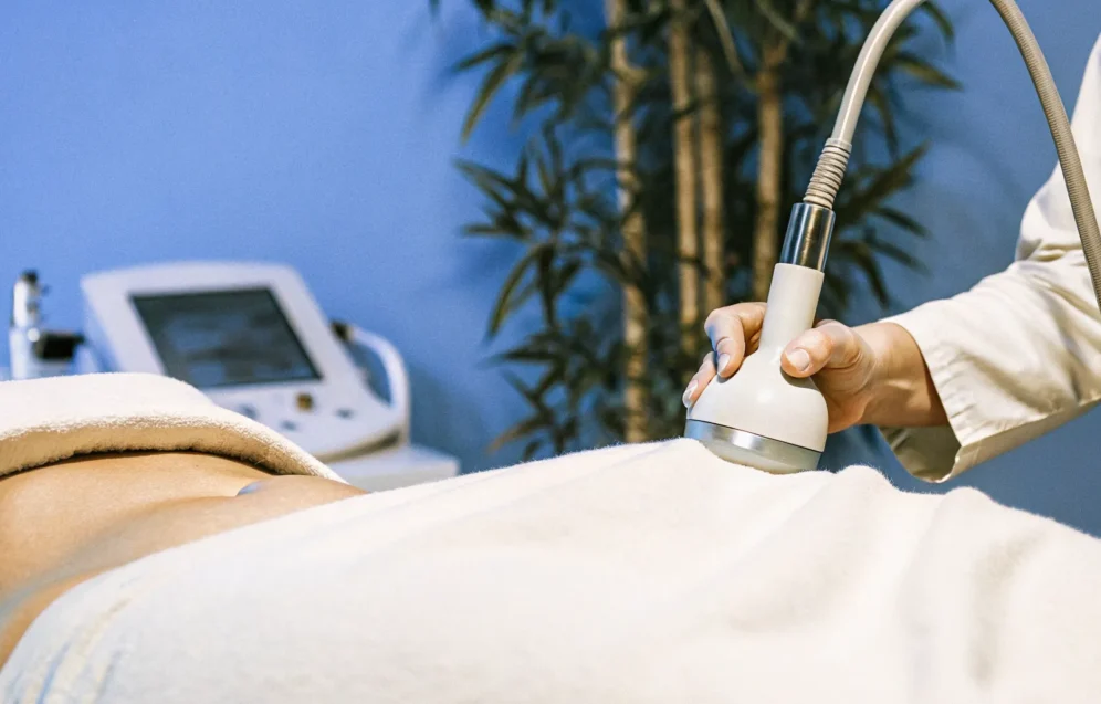 rf-microneedling-body-contouring-tampa rf-microneedling-body-contouring-tampa